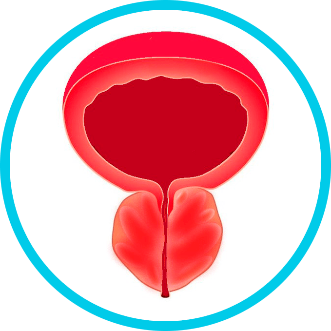 Symptomen van prostatitis